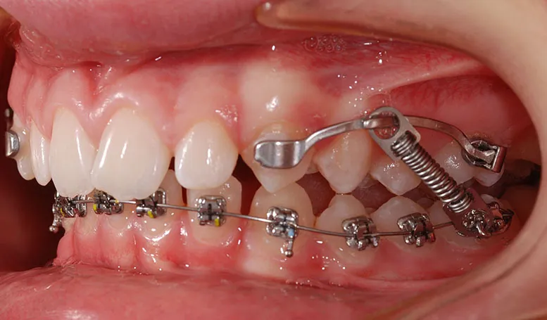 JVB Toronto ON, Innovative Orthodontics