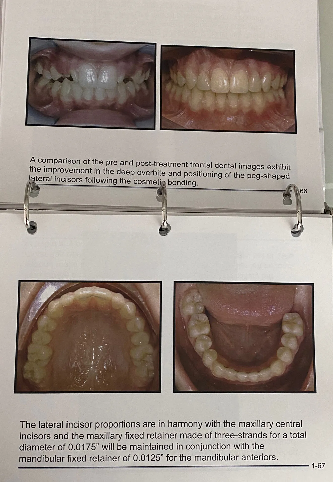 N Toronto ON, Innovative Orthodontics
