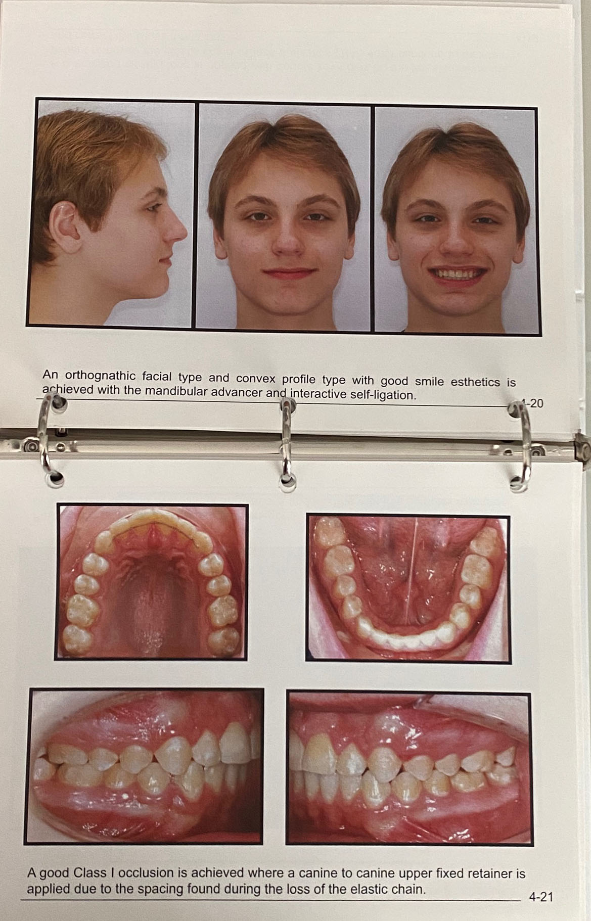 N Toronto ON, Innovative Orthodontics
