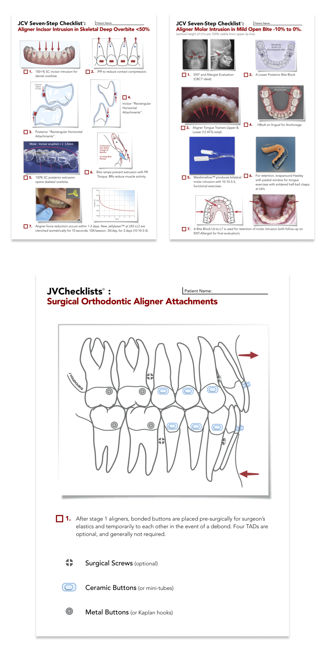 Seven- step checkpoints aligners